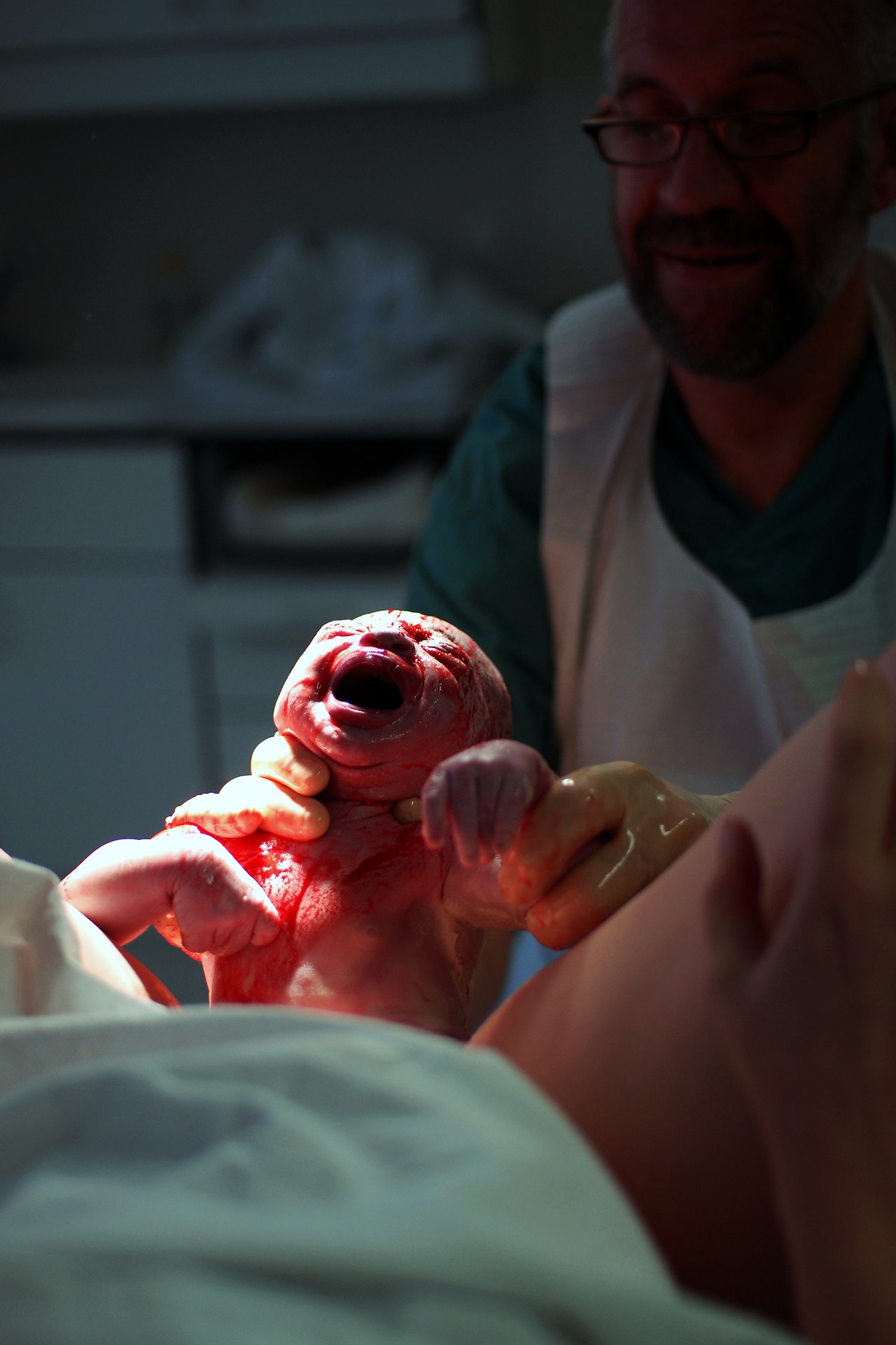 A newborn baby is held by a doctor immediately after birth, crying with its body covered in fluids.