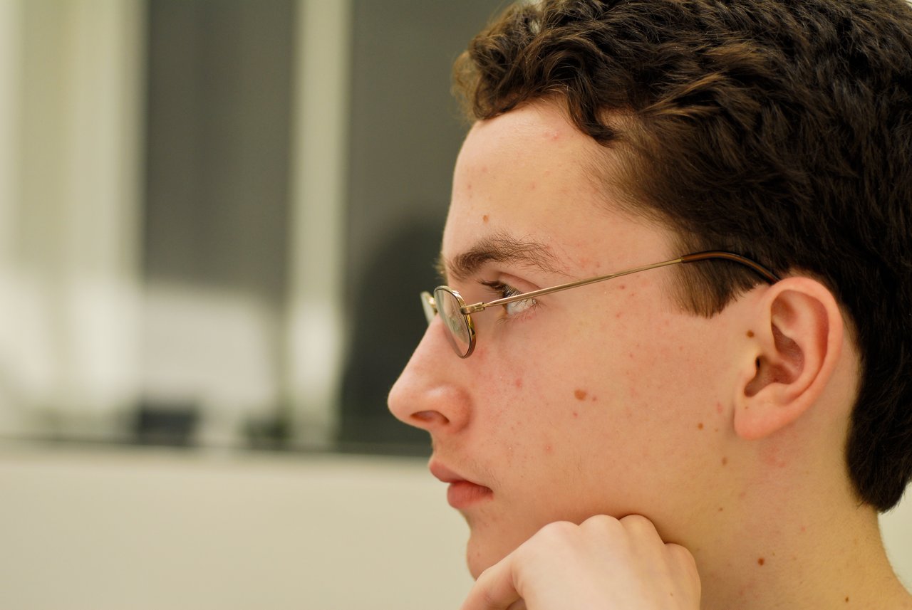 A young man with glasses looks intently to the side, resting his chin on his hand.