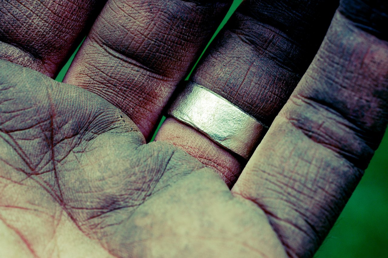 A close-up of a dirty, rough-skinned hand with a silver ring on one finger.