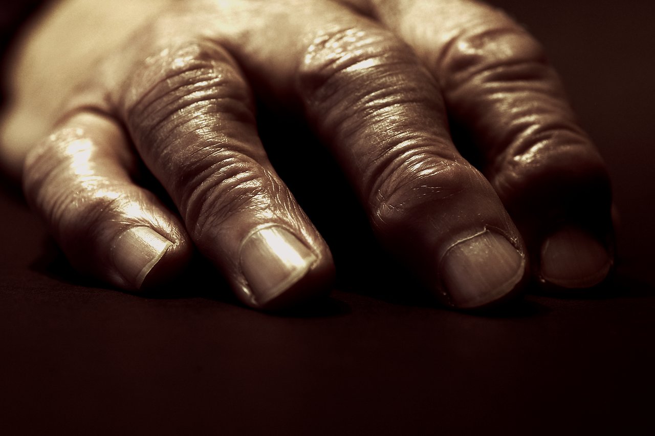 A close-up of an aged hand with wrinkles and rough skin, resting on a dark surface.