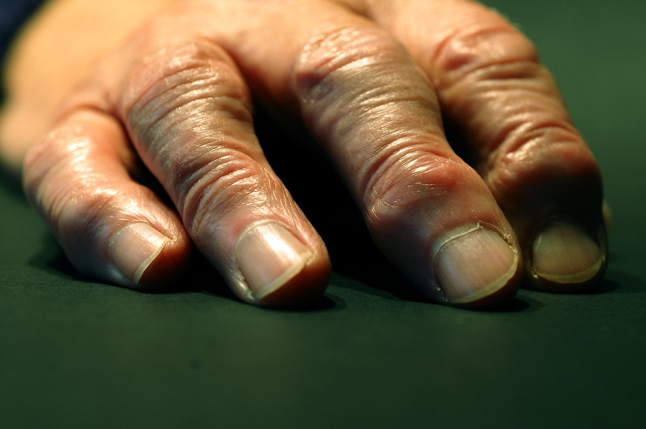 A close-up of an aged hand resting on a dark surface, showing wrinkles, veins, and worn fingernails.