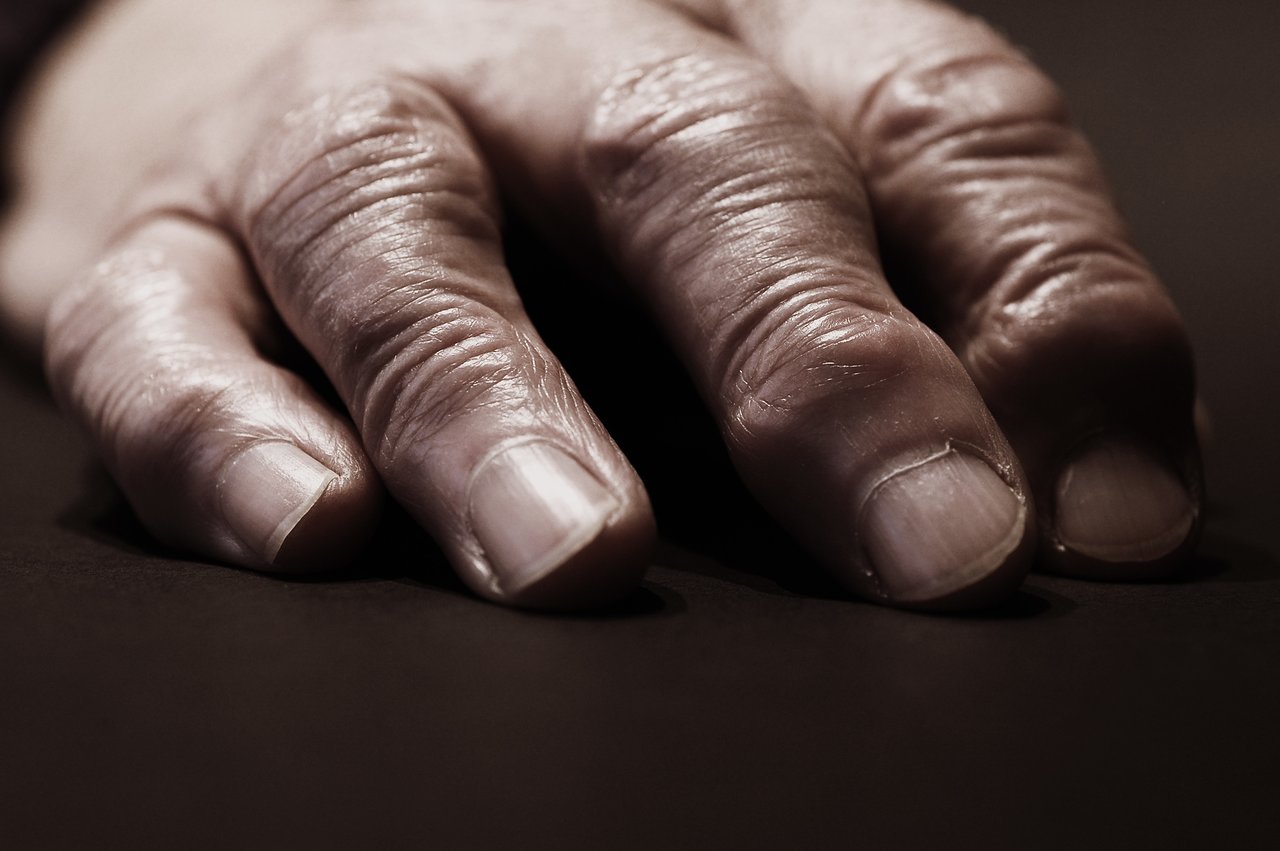 A close-up of an aged hand resting on a dark surface, showing wrinkles, veins, and rough skin texture.