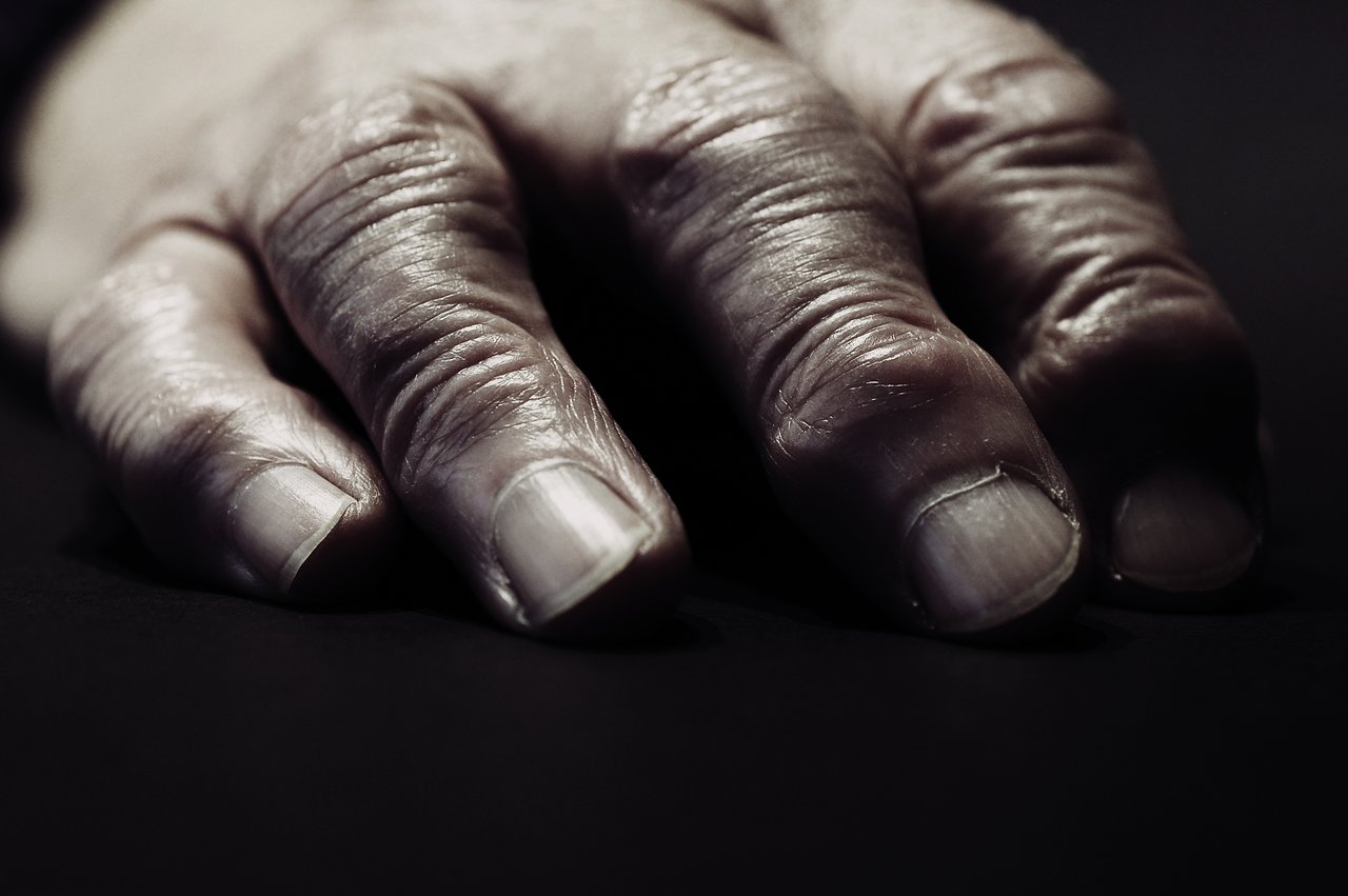 A close-up of an aged hand resting on a dark surface, showing wrinkles and rough skin.