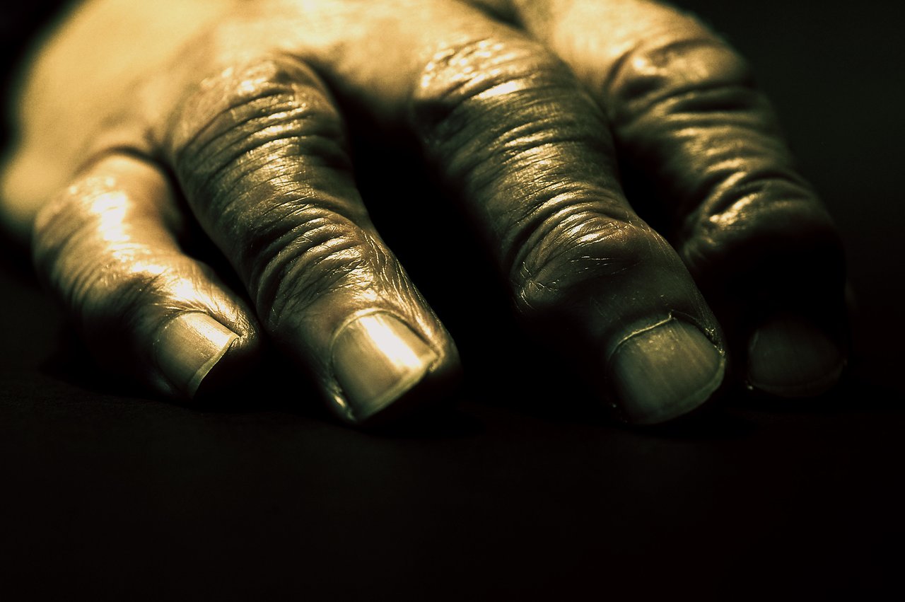 A close-up of an aged hand resting on a dark surface, showing wrinkles and texture.