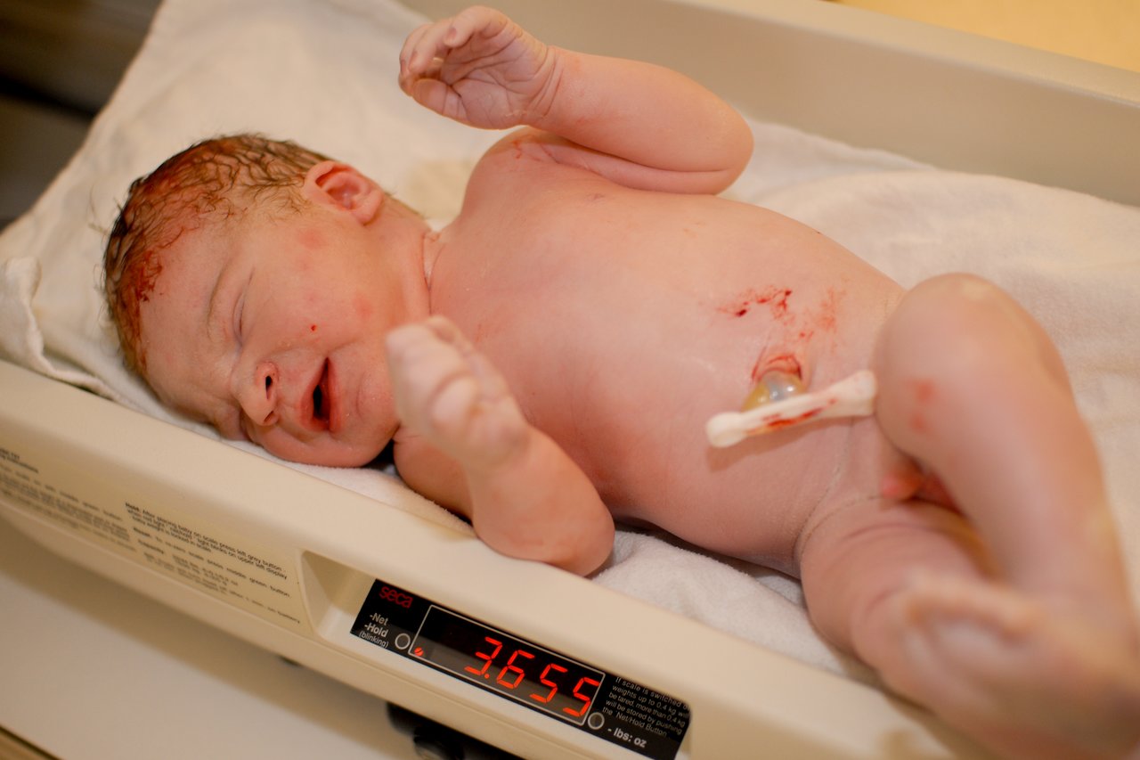 Newborn baby lying on a hospital scale, weighing 3655 grams, with an umbilical cord clamp attached.