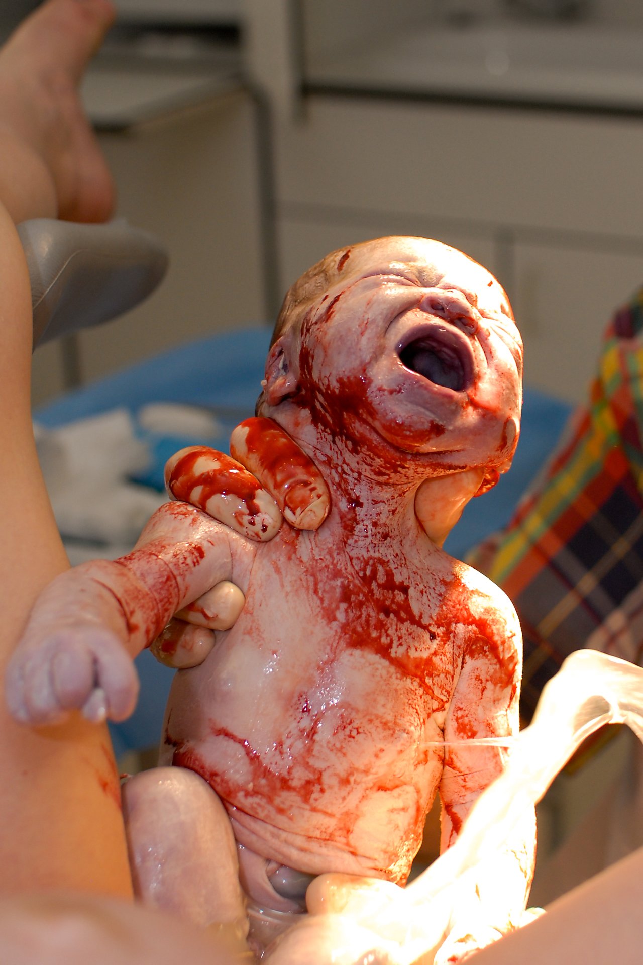 A newborn baby, covered in birth fluids, cries while being held just seconds after birth.