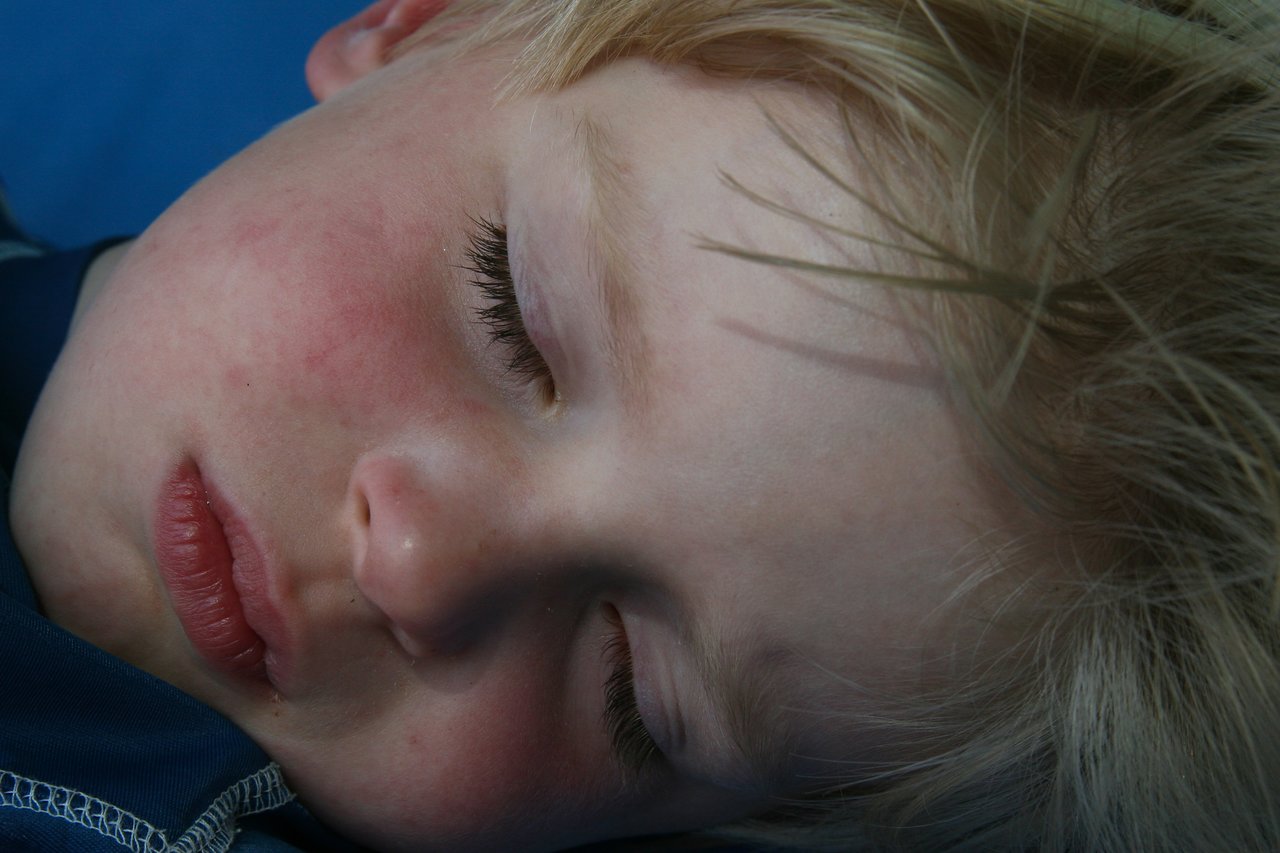 A young child with blonde hair is sleeping with eyes closed and face slightly flushed.