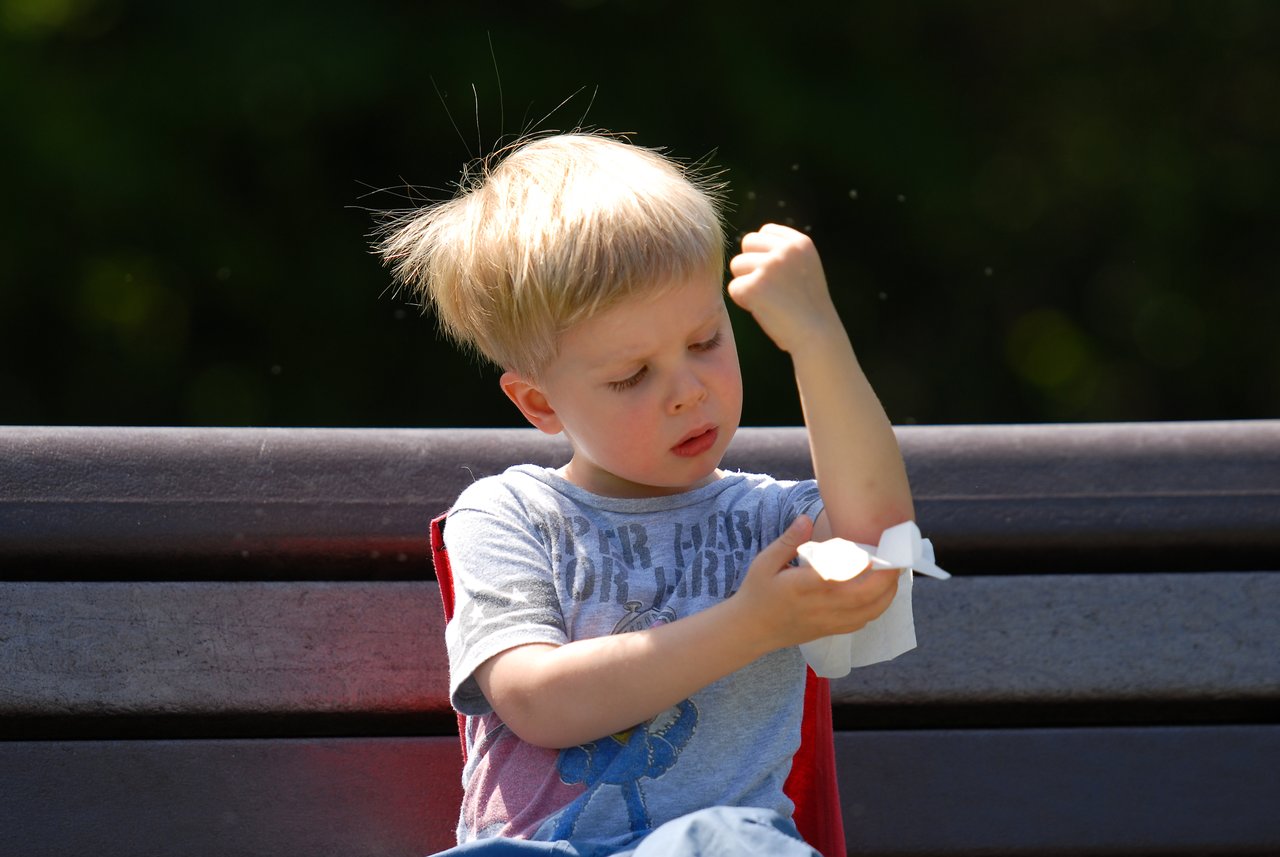 A young boy sits on a bench, cleaning a scrape on his arm with a tissue.