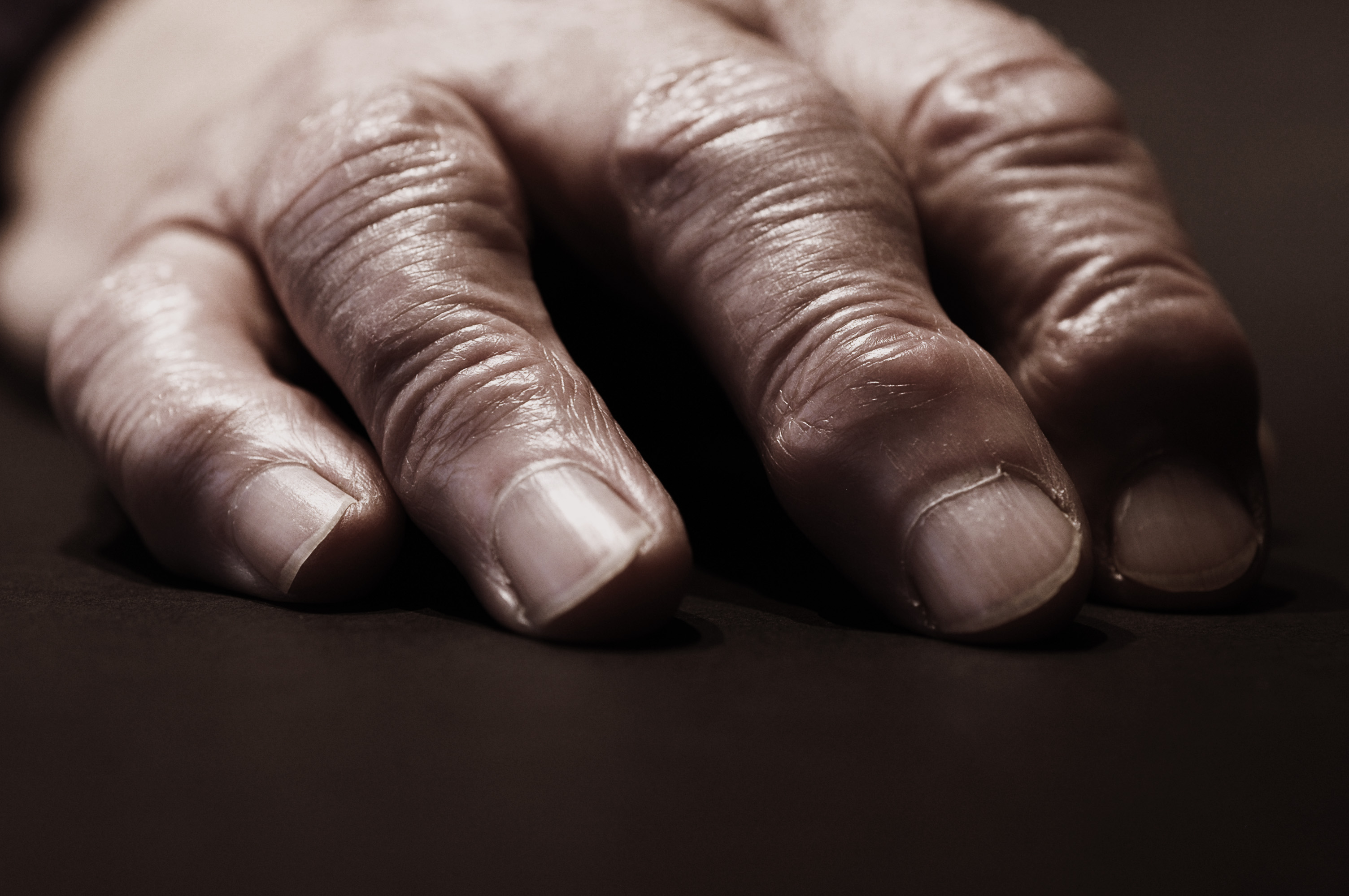 A close-up of an aged hand resting on a dark surface, showing wrinkles, veins, and rough skin texture.