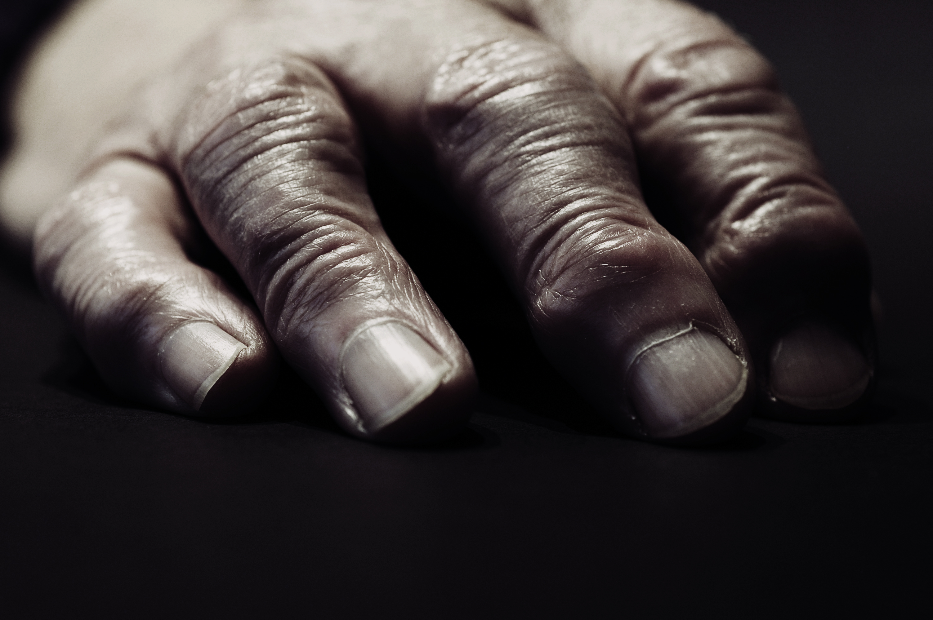 A close-up of an aged hand resting on a dark surface, showing wrinkles and rough skin.