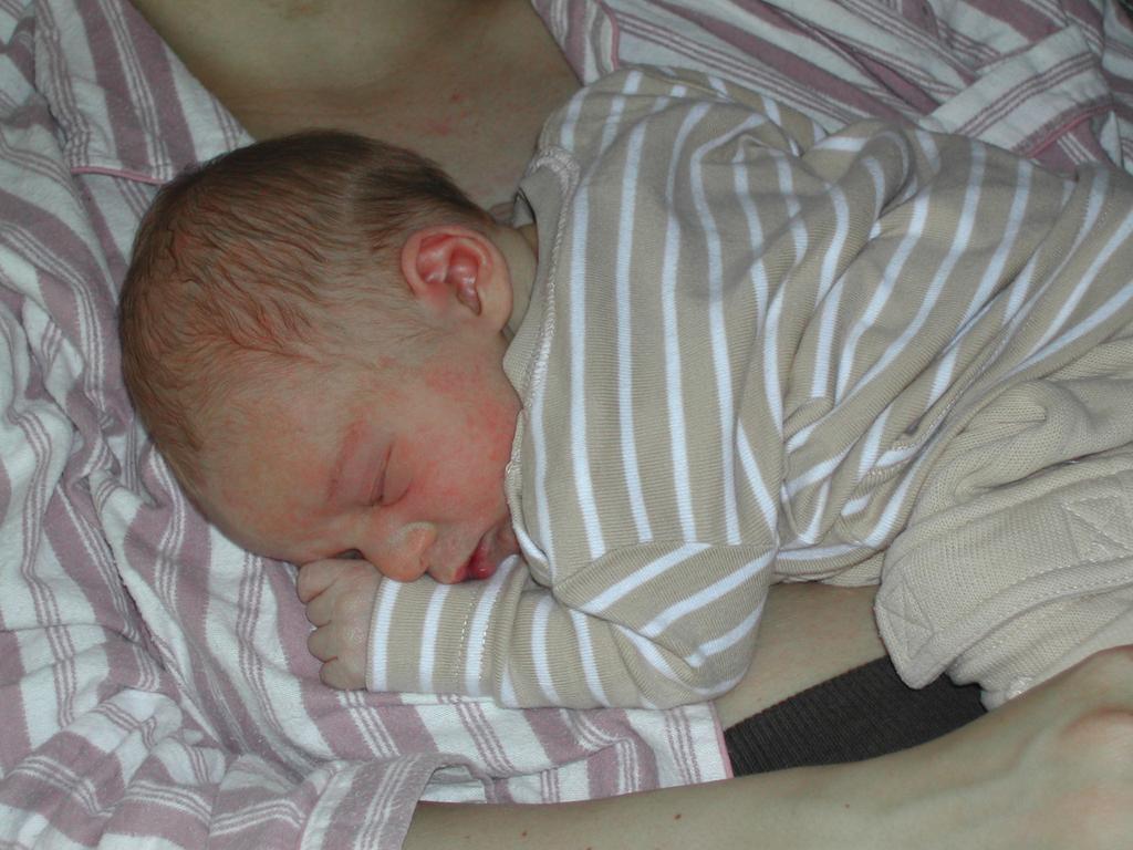 A newborn baby in a striped outfit sleeps on a caregiver's chest, resting peacefully.